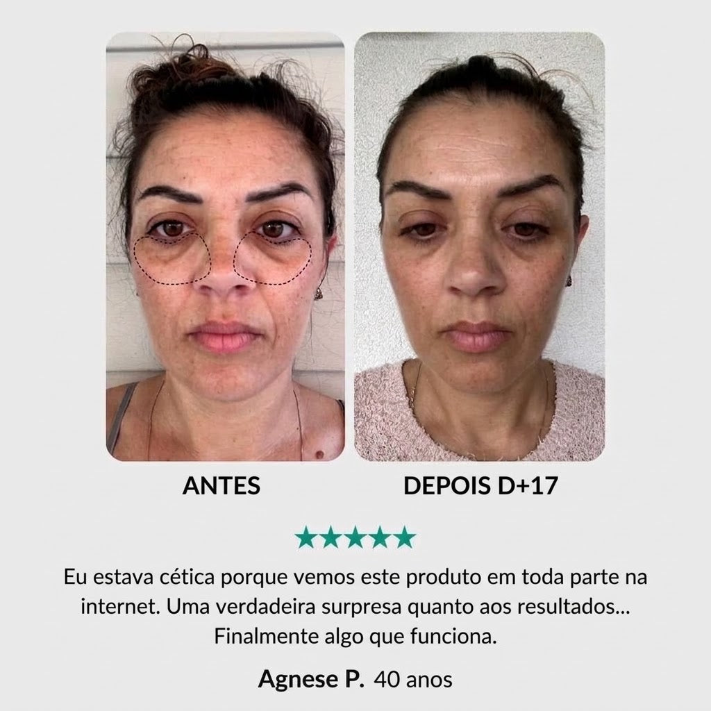 Tratamento Anti-Idade Completo: Para Olhos, Rosto e Pescoço
