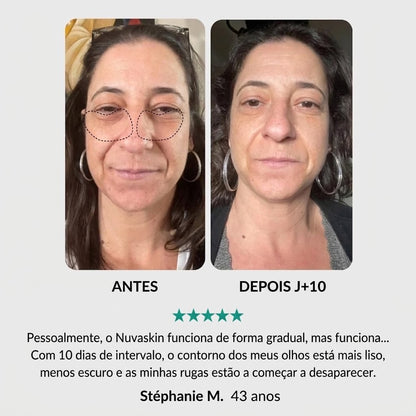 Tratamento Anti-Idade Completo: Para Olhos, Rosto e Pescoço