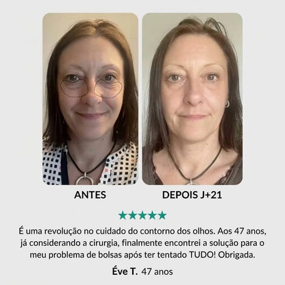 Tratamento Anti-Idade Completo: Para Olhos, Rosto e Pescoço